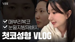 [성형 Vlog] 무보형물 코성형 + 눈밑지방재배치 + 얼굴지방이식 풀패키지✨ | 상담부터 1개월 후 비교까지