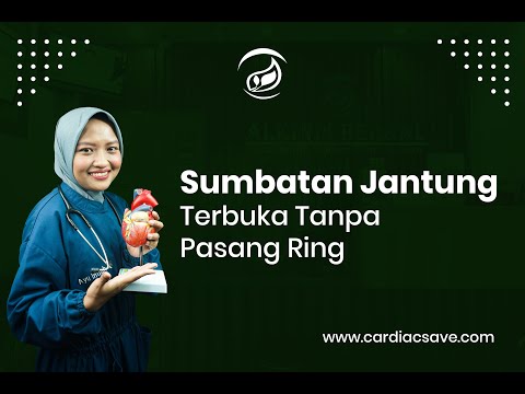 Binaragawan anggota kecil Persiapan untuk potensi peningkatan buy di Chelyabinsk