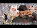 Mr Mime Reaction Jurgen Klopp Match Interview Arsenal 3 vs 1 Liverpool 04/02/2024