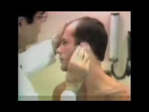1982 The AIDS Epidemic Begins.wmv