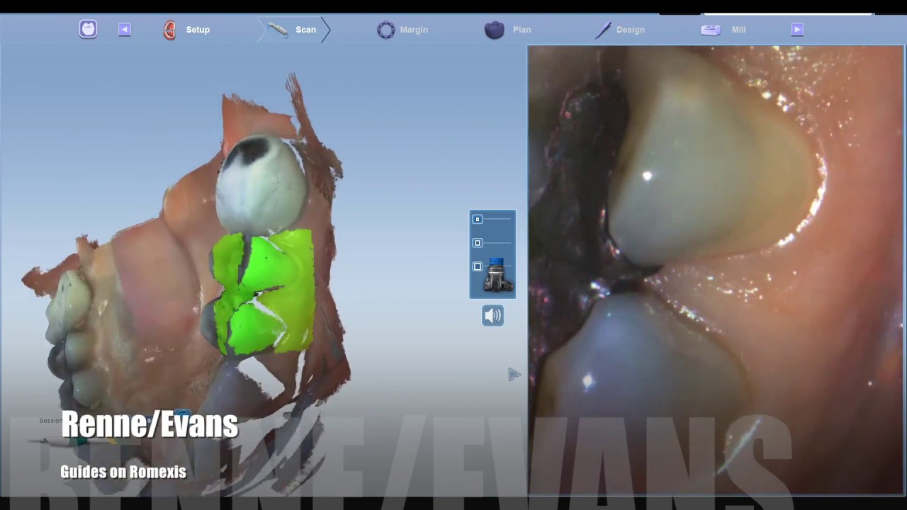 Romexis Emerald Fully Guided tutorial