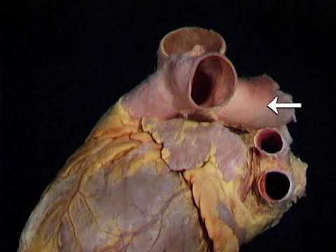 Anatomía Humana - Corazón - Sistema Circulatorio