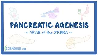 Pancreatic agenesis (Year of the Zebra 2026)