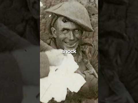 The truth behind the famous shell shock man…