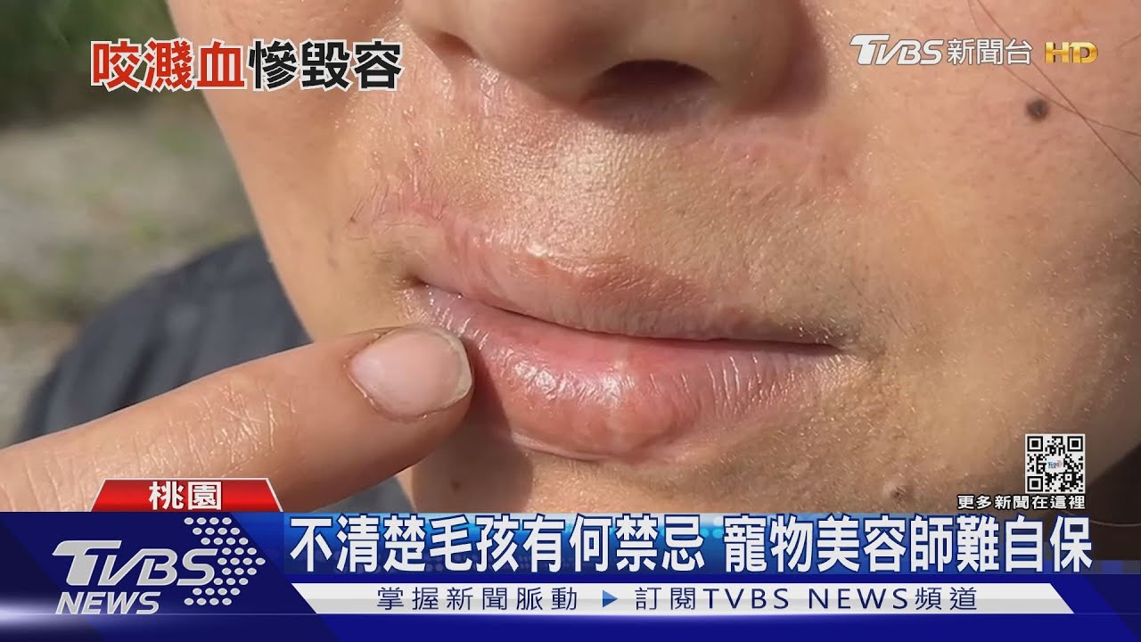 鼻子、嘴唇被狠咬！美容師檢查指甲到一半　狗狗竟失控暴走