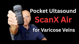 Pocket Ultrasound for Varicose Vein Treatment: Why Duplex is Essential and ScanX Air Demo and Review