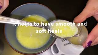 How to Get Rid of Dry Cracked Feet FAST & NATURALLY | HARD SKIN TREATMENT\ HOME Remedies /