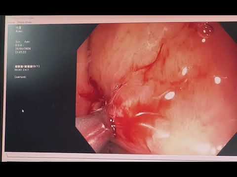 Pulse Multispeciality Hospital|Navale Bridge,Pune