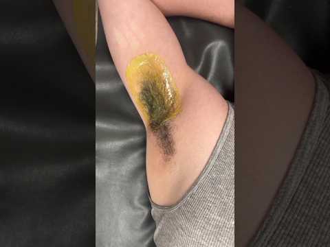 Hairy men’s armpit wax. Not all of my wax strips are perfect! #esthetician #waxing #armpitwaxing