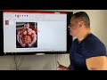 Omuz Nasıl Genişletilir (Anatomik Açıklama & Antrenman )