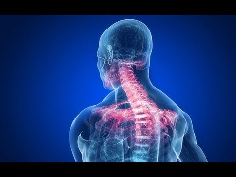 IL DOLORE CERVICALE E LOMBARE