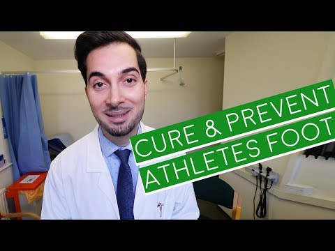 Athlete's Foot | How To Cure Athlete's Foot | Athlete's Foot Cream (2024)