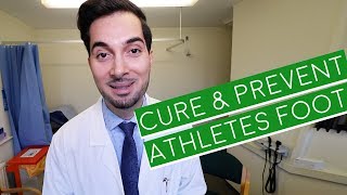 Athlete&#39;s Foot | How To Cure Athlete&#39;s Foot | Athlete&#39;s Foot Cream (2019)