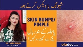 Bumpy Skin After Shaving - Wax Ke Baad Dano Ka Ilaj - Avoid Razor Bumps - Ingrown Hair After Shaving