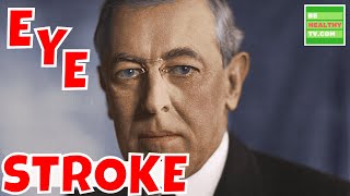 WHAT IS EYE STROKE  Eye Stroke Symptoms Risks and Treatment