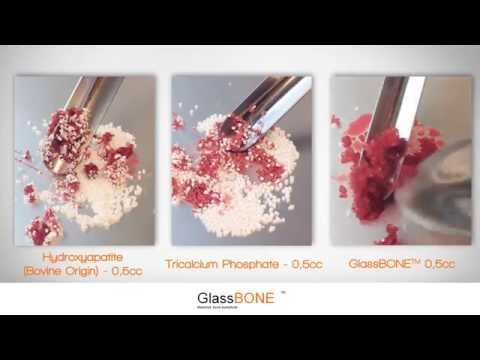 Noraker | Glassbone - Comparison Cohesiveness Blood Test