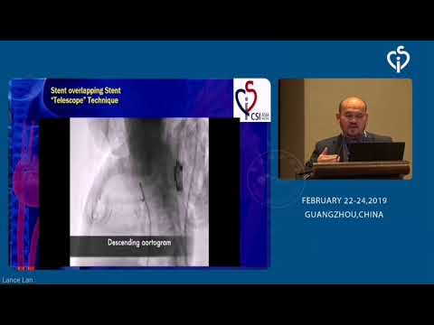 CSIAP 2019 lecturing: How to stent the PDA, tips and tricks