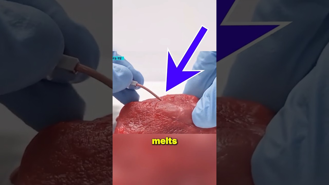 Comment If You Need This Injection