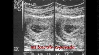 Presuntos Implicados - &quot;Mi Pequeño Tesoro&quot;. Mi bebé sesamito Mauricio Alejandro.