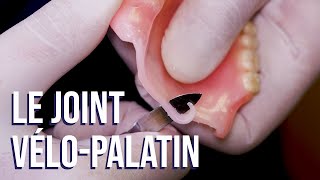 Le joint vélo-palatin en prothèse amovible complète