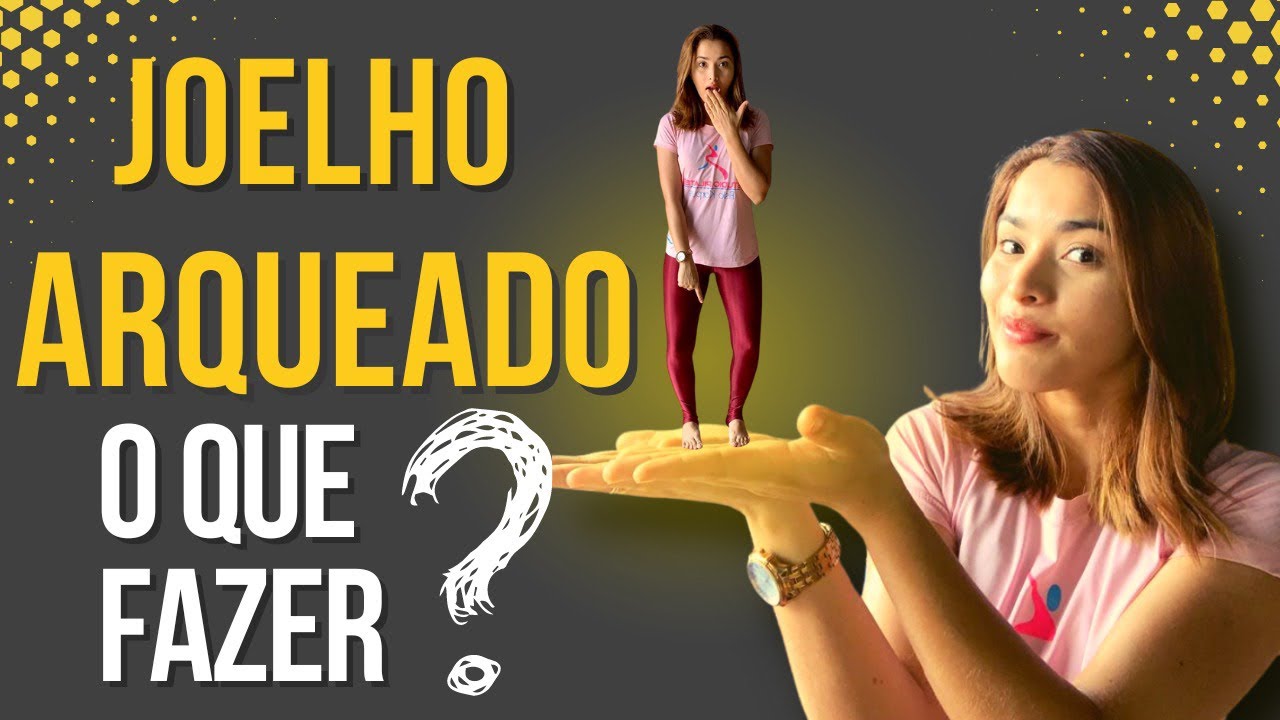 Você tem um joelho assim?( ) conheça sobre o joelho varo e o que fazer para tratar e prevenir!!