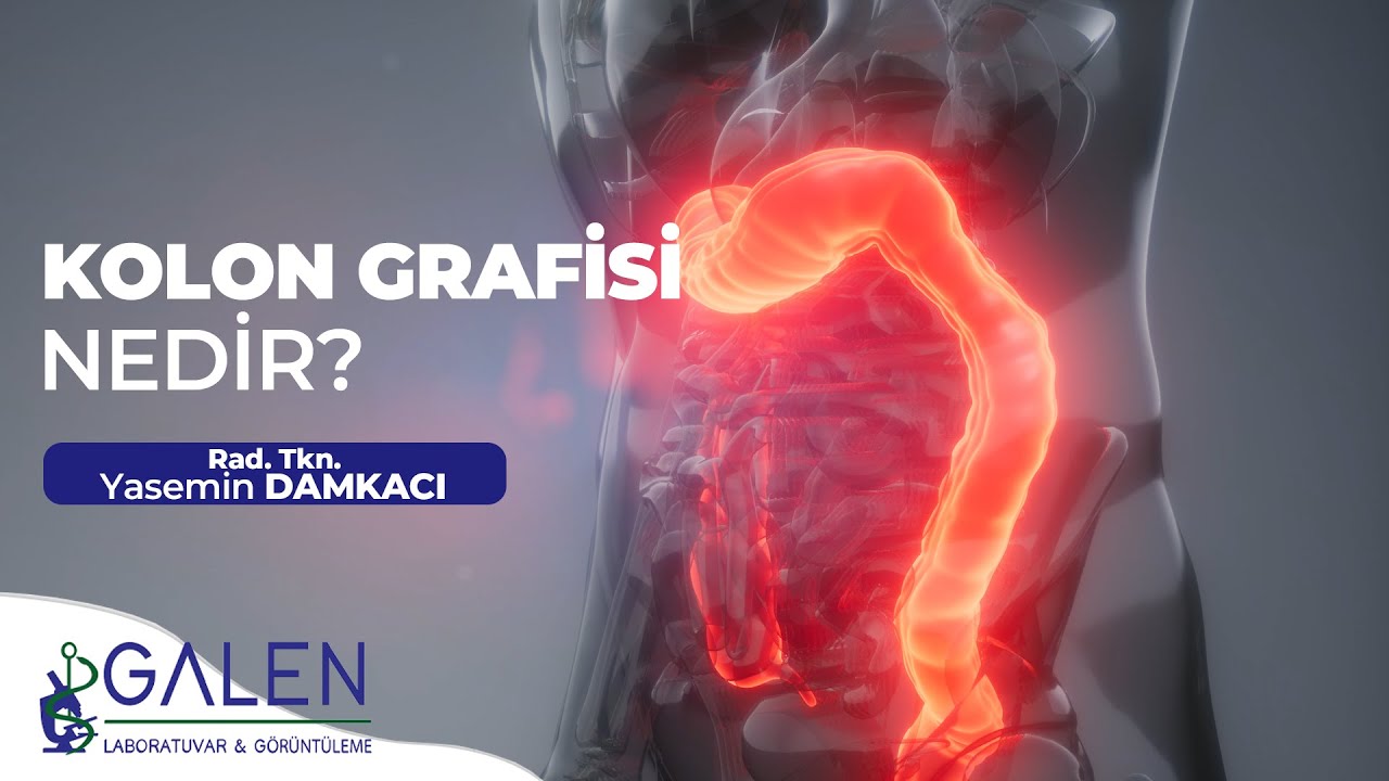 Kolon Grafisi