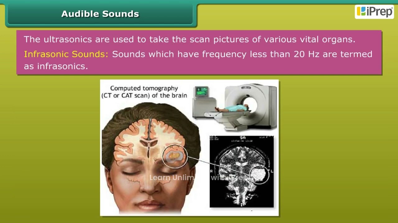 Audible and Inaudible Sounds  | Sound | Science | Class 8 | iPrep