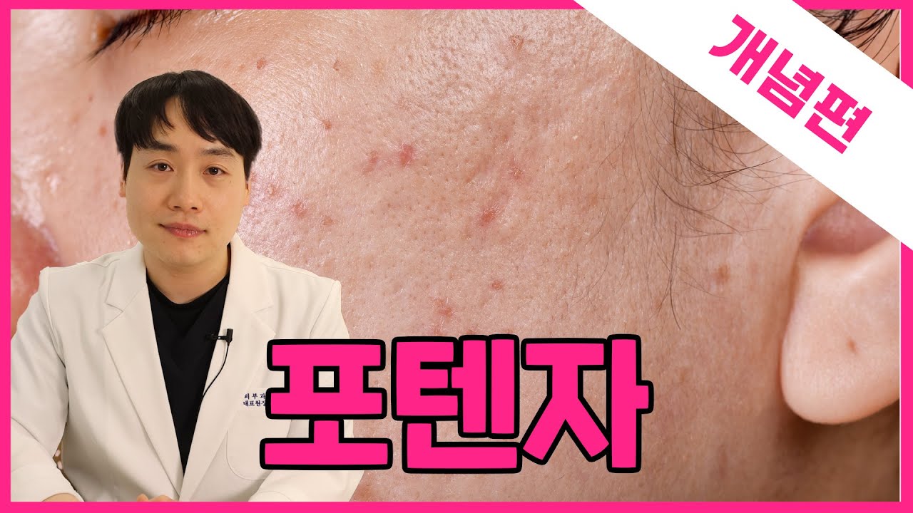 related_video_thumbnail