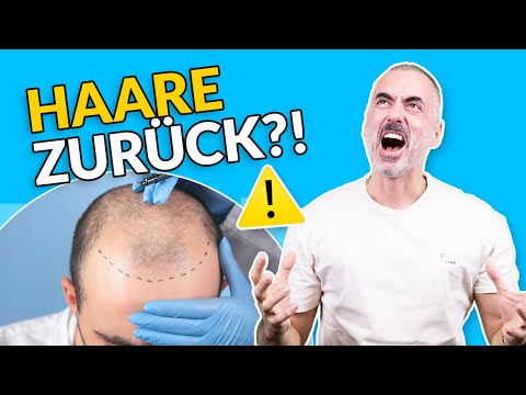 HAIR TRANSPLANTATION – How the procedure works - Report by Prof. Sinis | Plastic Surgery Coach