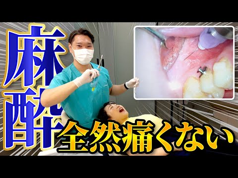 【痛くない歯医者】麻酔が効く仕組み＆痛みを抑える工夫を全部見せます！