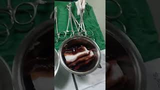 Download lagu Common instruments used in C-section surgery #csection #surgery mp3 Download lagu Common instruments used in C-section surgery #csection #surgery mp3