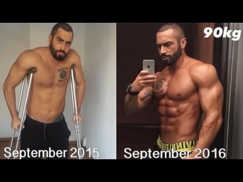 Lazar angelov Transformation After 4 Surgeries _ Fitness Motivation