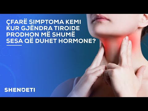 Çfarë simptoma kemi kur gjëndra tiroide prodhon më shumë sesa që duhet hormone?