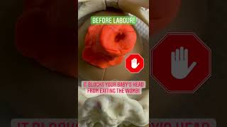 Download lagu Vaginal examinations in labour - what are they for?  #youtubeshorts #pregnancy #birth mp3