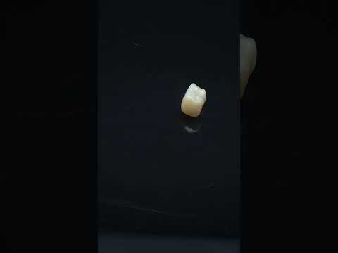 YouTube 썸네일
