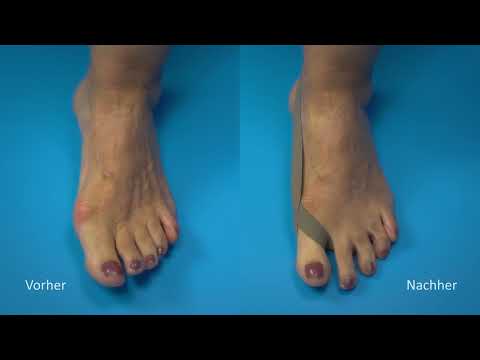 Wie ziehe ich die Taping Loops richtig an? Gebrauchsanweisung