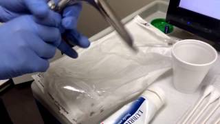 IUD insertion-- Training video
