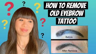 How to Remove Old and Dark Eyebrow Tattoo!