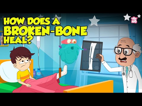 How Bone Fractures Heal? | How Does a Broken Bone Heal? | Process of Bone Healing | Dr. Binocs Show