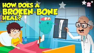 How Bone Fractures Heal? | How Does a Broken Bone Heal? | Process of Bone Healing | Dr. Binocs Show