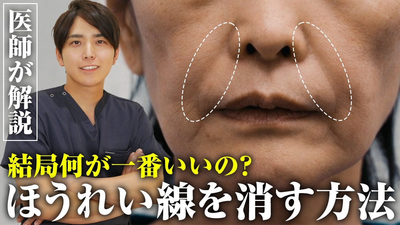 医師が教えるほうれい線を消す方法！原因別の最適治療を教えます。