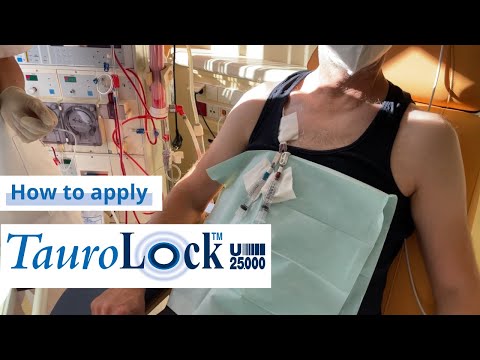 TauroLock™-U25.000 in dialysis catheters