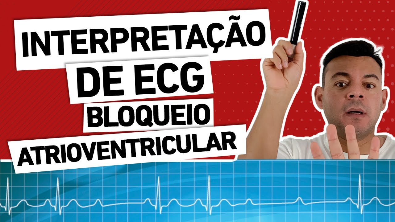 INTERPRETAÇÃO DE ECG: Bloqueio atrioventricular e condutas