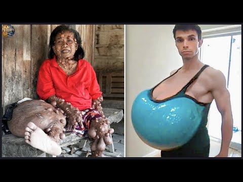 10 Humans Who Defied Science: You Have To See It To Believe It