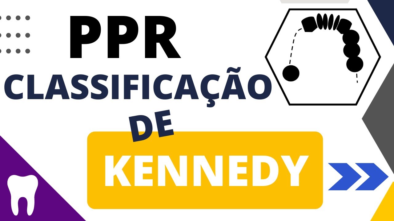 Entenda a CLASSIFICAÇÃO DE KENNEDY