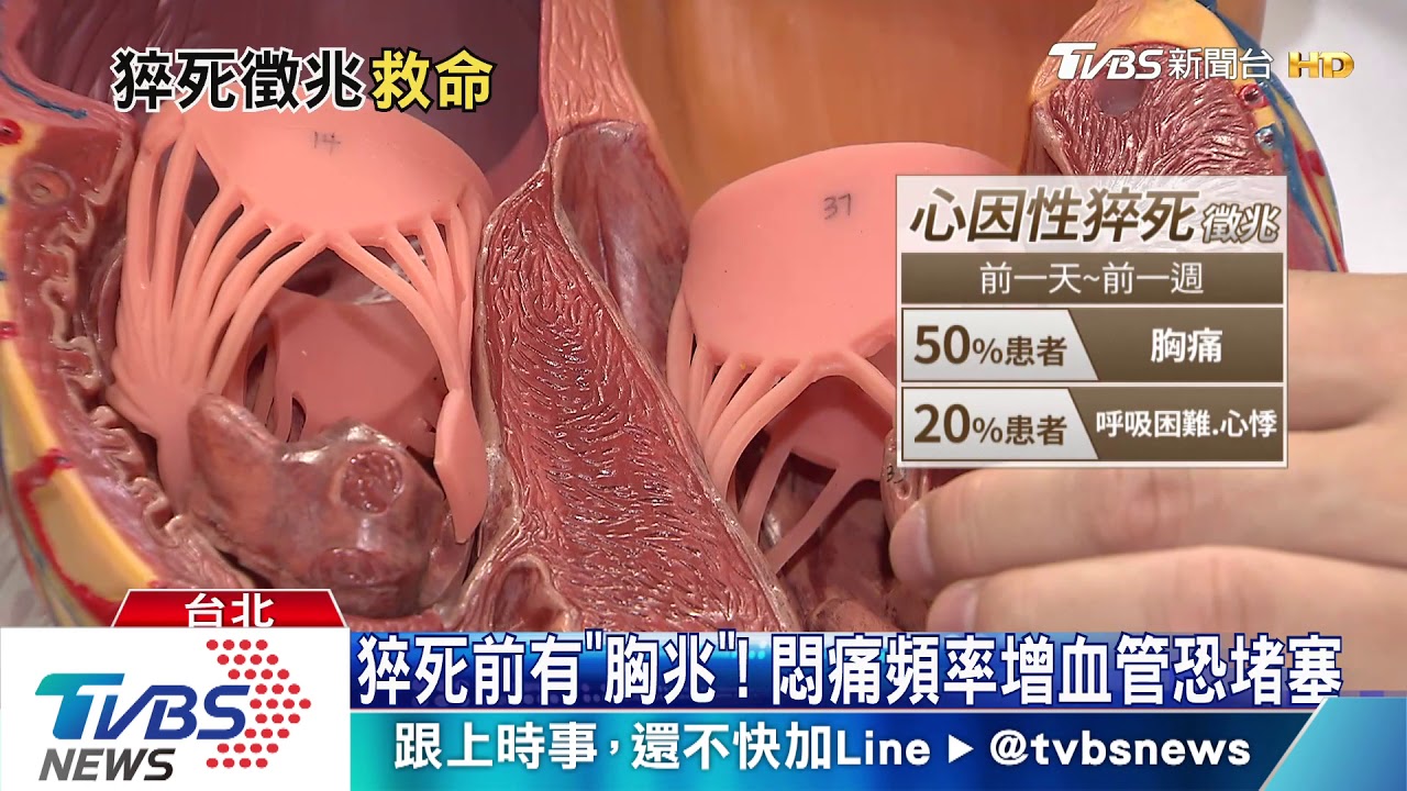 「心因性猝死」年奪萬人性命 青壯年如何預防?
