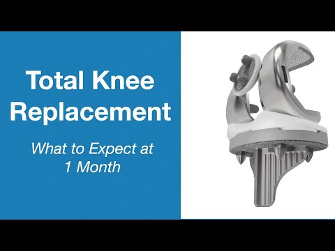 Total Knee Replacement: 30 Day Progress Check