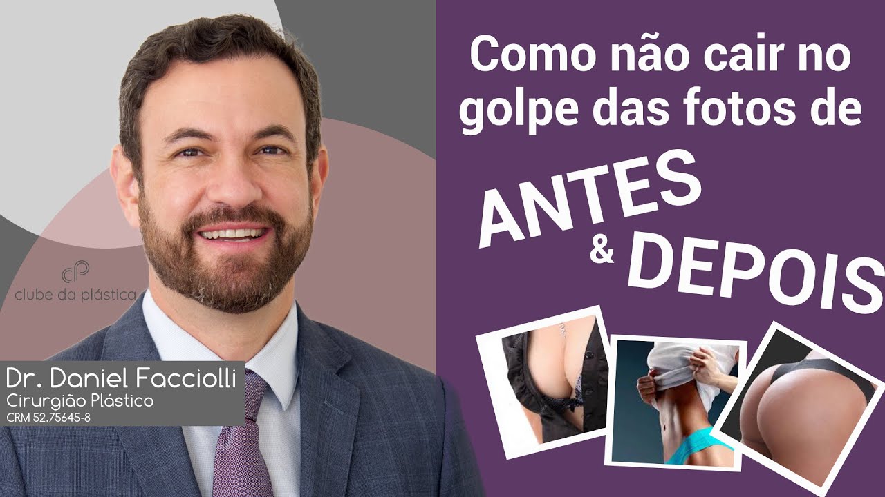 Clube da Plástica: como não cair no golpe das fotos de ANTES e DEPOIS