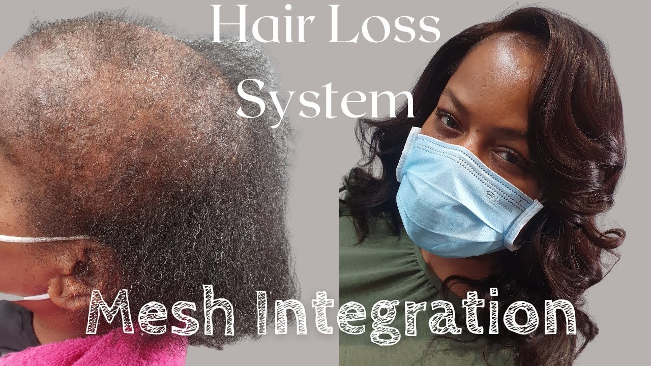 Mesh Integration Hair Loss System: No braided weave | No wig | Minimal tension