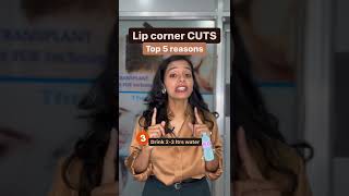 Lip Corner Cuts Causes l #shorts